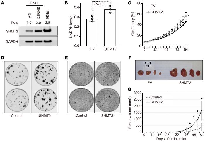 Effect of SHMT2 overexpression on Rh41 cell growth and transformation.
(...