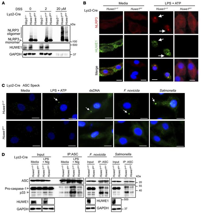 HUWE1 promotes inflammasome assembly and ASC speck formation.
(A) Immuno...