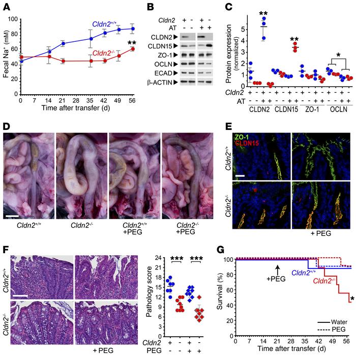 Insufficient luminal hydration leads to increased mortality in claudin-2...