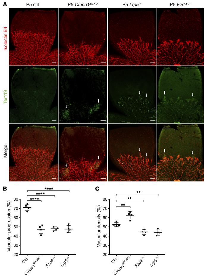 Comparison of retinal vascular phenotypes of Ctnna1 endothelial conditio...