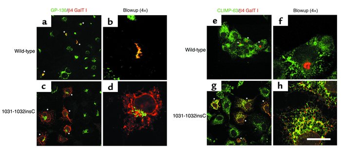 Localization of wild-type and 1031-1032insC β4GalT I overexpressed in CO...