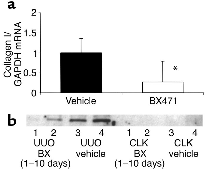 Collagen I mRNA and protein expression. (a) Renal collagen mRNA expressi...