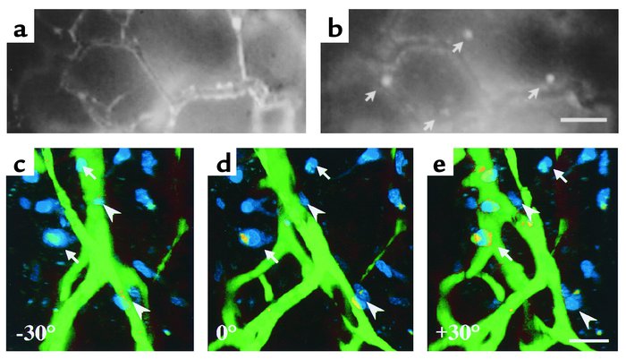 Glioma cells invade the adjacent host tissue by perivascular migration a...