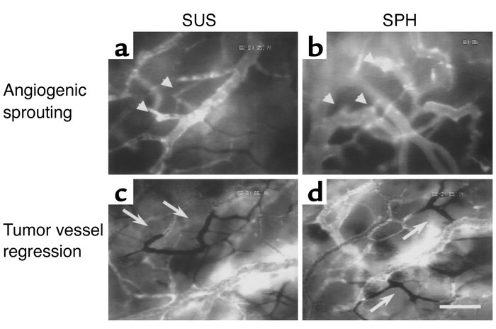 Microvasculature of C6 glioma 2 weeks after intracranial implantation. N...