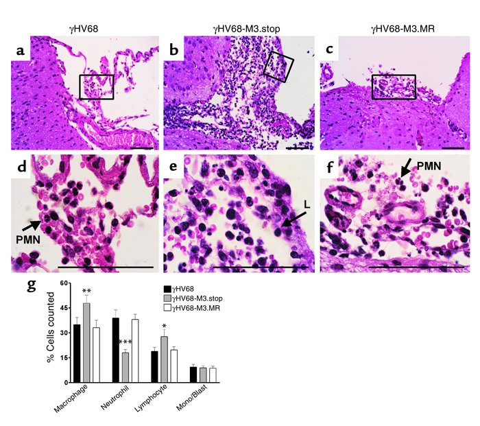 The M3 protein alters the inflammatory response to γHV68. Hematoxylin an...