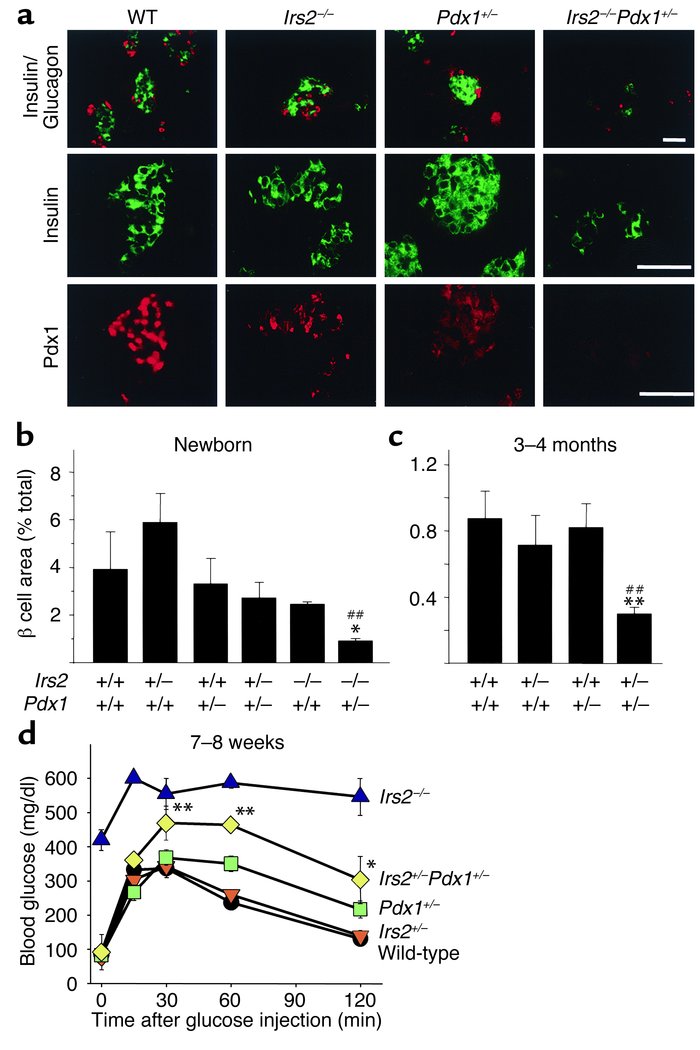 Islet morphology and quantification from Irs2+/–Pdx1+/– intercross mice ...