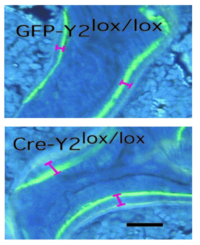 Effect of hypothalamus-specific Y2 receptor deletion on bone mineralizat...