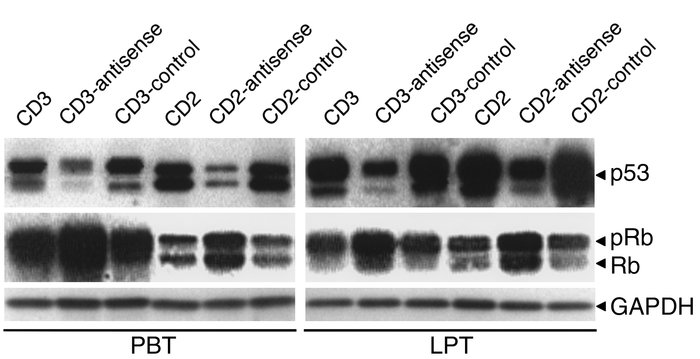 Effect of antisense treatment on p53 and Rb levels in PBTs and LPTs. Tre...