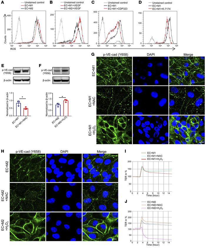 ROS functions downstream of VCAM1 in regulating macrophage-mediated perm...