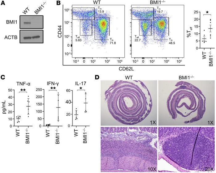 Characterization of conditional BMI1-deficient mice reveals a proinflamm...