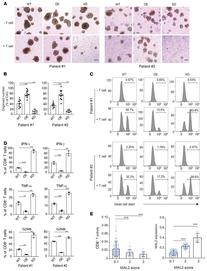 Depletion of MAL2 enhances CD8+ T cell cytotoxicity in human TNBC tumors...