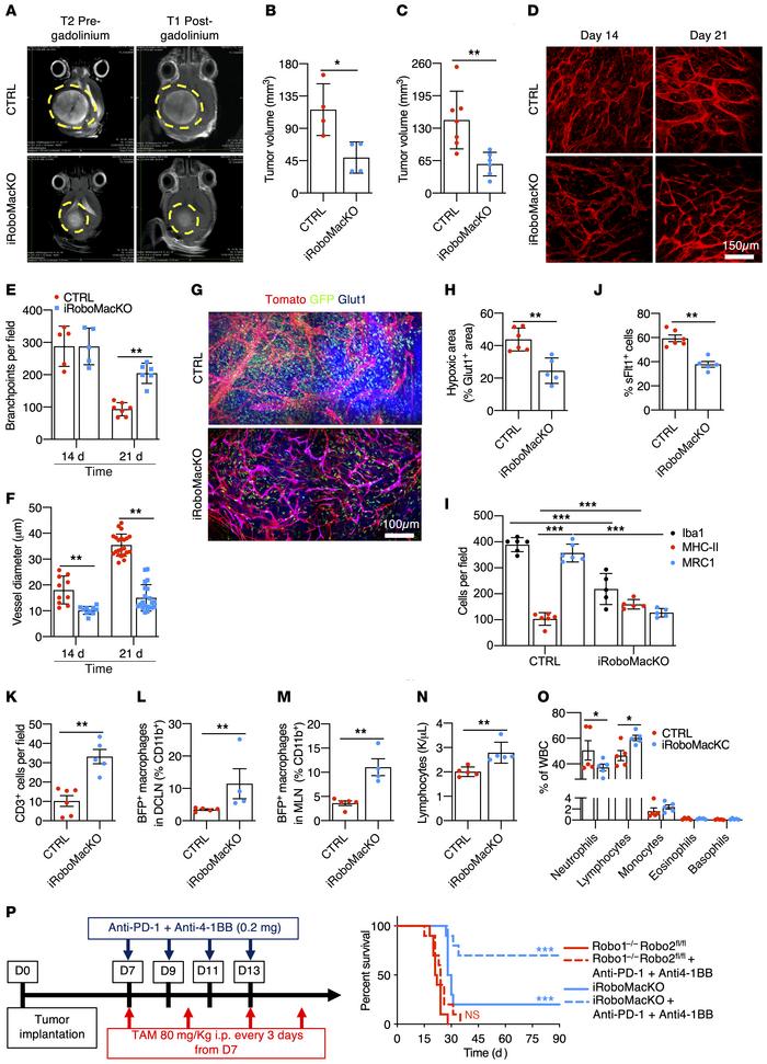 Macrophage-specific Robo1/2 knockout normalizes the TME.
(A) MRI images ...
