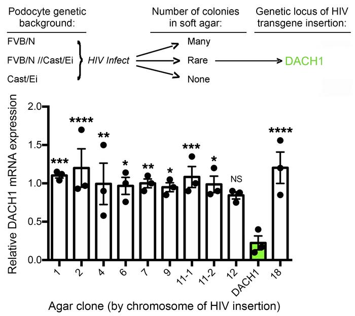 Diminished DACH1 expression identified as rescuing podocyte injury susce...