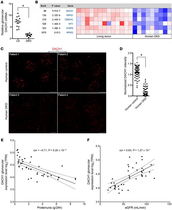 In human DKD patients, levels of podocyte DACH1 expression are reduced a...