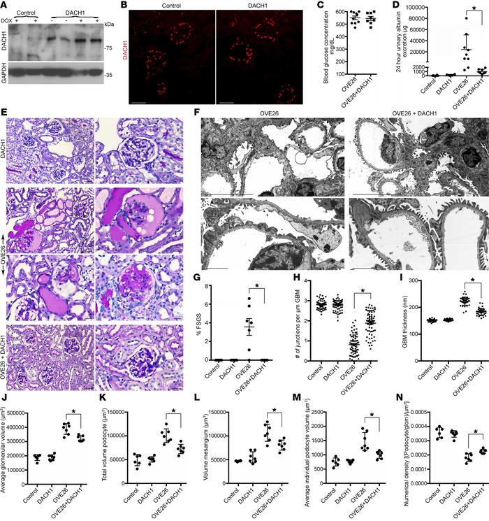 Inducible podocyte-specific DACH1 overexpression protects from DKD.
(A) ...