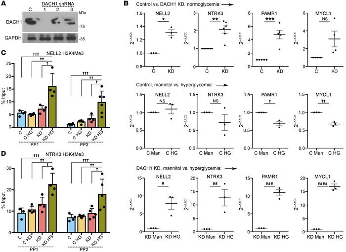 DACH1 knockdown in podocytes combined with hyperglycemia triggers target...