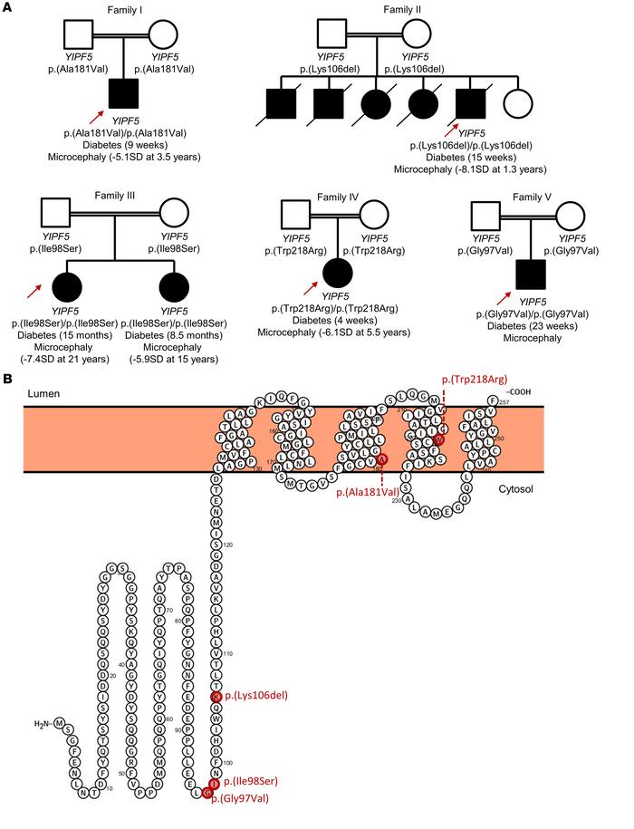 Identification of homozygous YIPF5 mutations in 6 patients with neonatal...