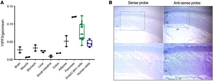 YIPF5 is expressed in human pancreatic tissue and brain.
(A) YIPF5 mRNA ...