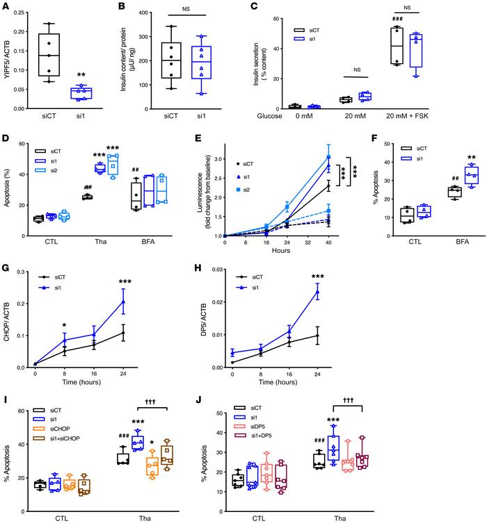 YIPF5 deficiency does not affect insulin secretion but sensitizes β cell...