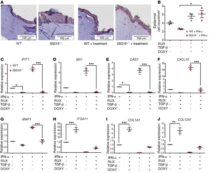 Combined treatment with RUX, DOXY, and TGF-β1 normalizes epidermis forma...