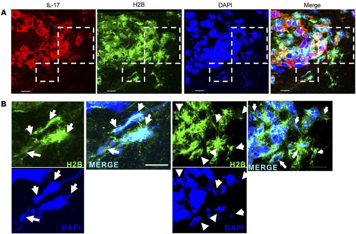 Expression of T cell extracellular traps in acne lesions.
(A) Confocal i...