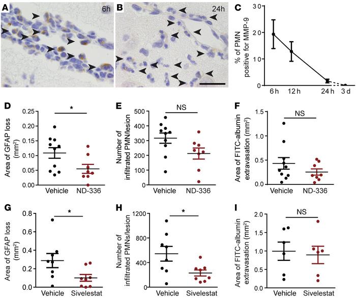 Inhibition of MMP-9 and elastase results in a significant reduction of a...