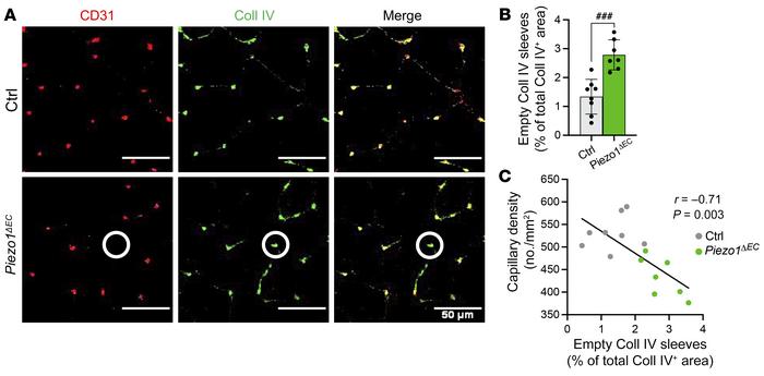 Protection against endothelial microvascular rarefaction.
(A) Immunohist...