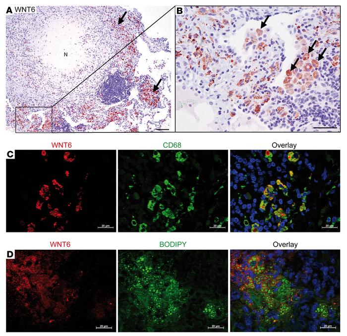 WNT6 is expressed in foamy macrophages during pulmonary TB.
(A and B) Im...