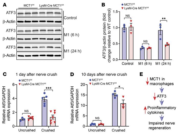 MCT1 determines the immune responses of macrophages potentially through ...