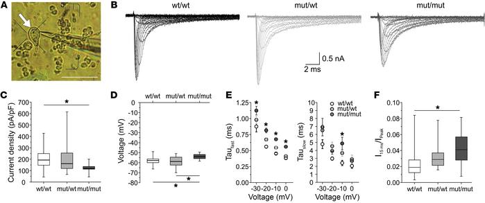 Slowed inactivation of Na+ currents in acutely isolated cerebellar Purki...