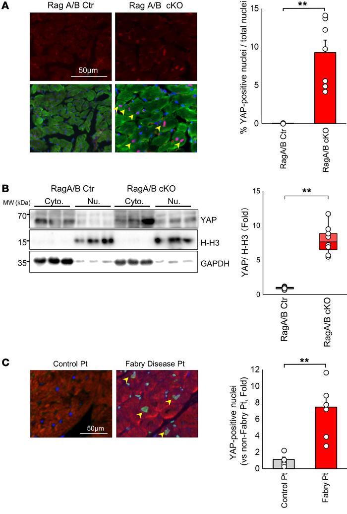Nuclear accumulation of YAP in RagA/B cKO mouse hearts.
(A) Representati...