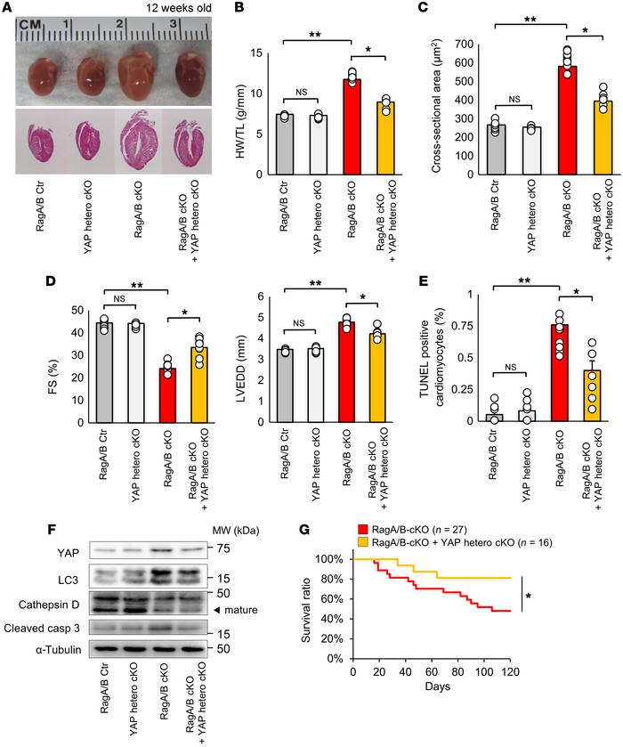 Heterozygous deletion of YAP in RagA/B cKO mice reduces cardiac hypertro...