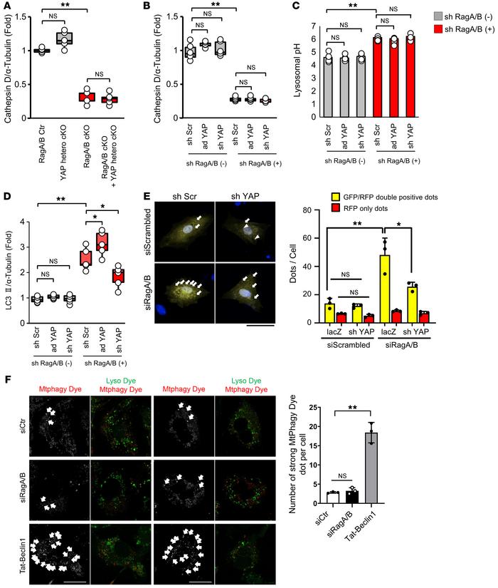 Downregulation of YAP attenuates autophagy without affecting lysosomal f...