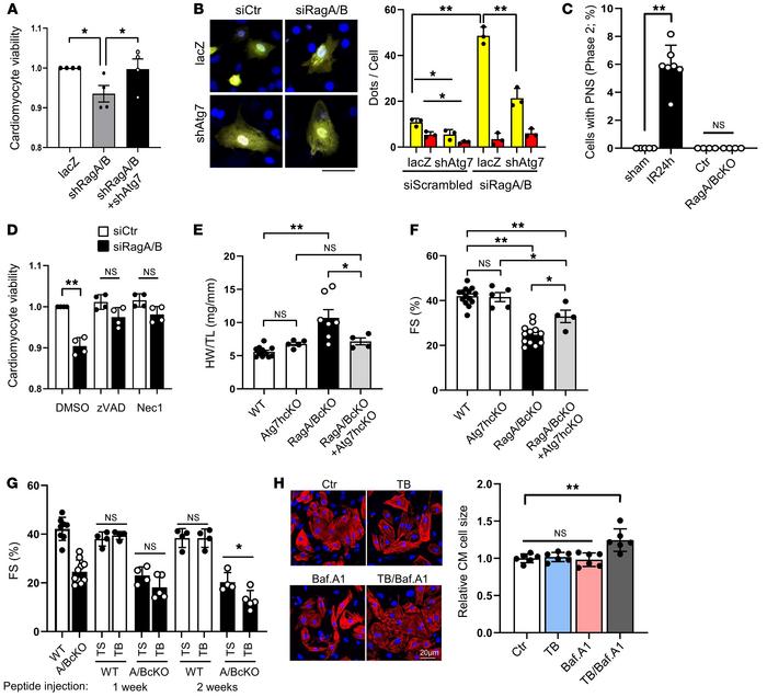 Suppression of autophagy alleviates cardiac dysfunction in RagA/B cKO mi...