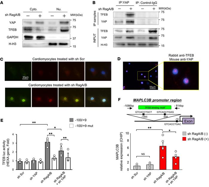 Endogenous YAP interacts with TFEB in CMs transduced with Ad-sh-RagA/B a...