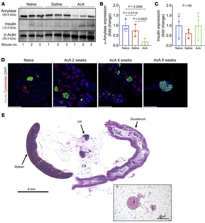 Chemical pancreatectomy causes nonregenerative ablation of exocrine panc...