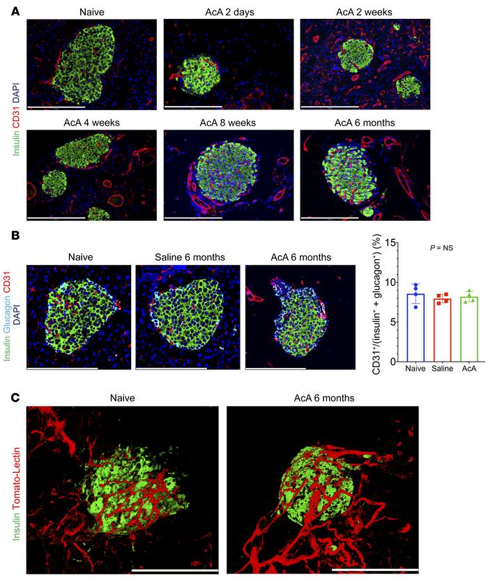 Chemical pancreatectomy preserves the integrity of islet vasculature.
(A...