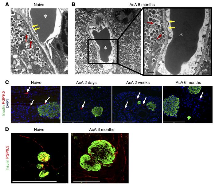 Chemical pancreatectomy preserves the ultrastructure of islet capillarie...