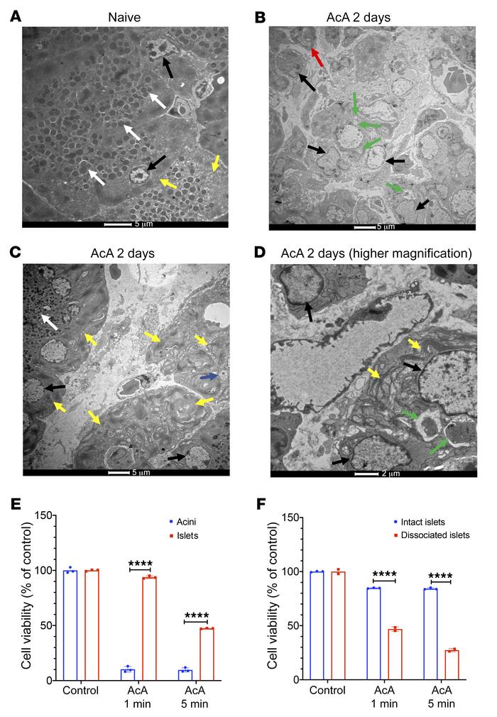 Mode of cell death and acinar cell susceptibility to cell injury after A...