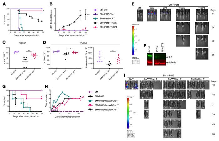Inhibition of Fli-1 prevents aGVHD and preserves the GVL effect.
(A–F) L...
