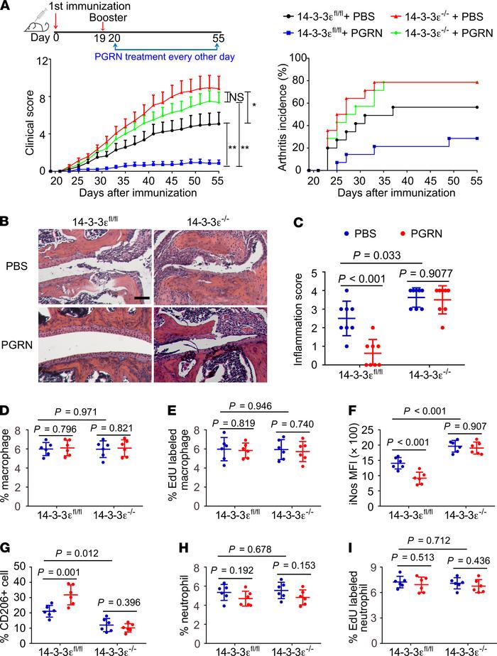 Global knockout of 14-3-3ε renders B6 mice highly susceptible to CIA.
(A...