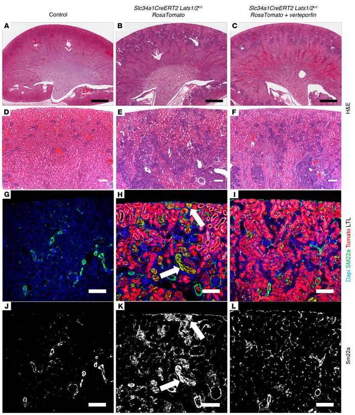 Treatment with verteporfin, a Yap inhibitor, partially rescues Lats1/2 d...