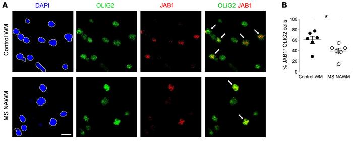 Expression of JAB1 in brain of MS patients.
(A) Representative immunoflu...