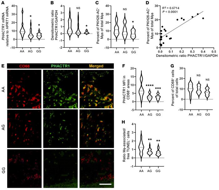 Human monocyte–derived and atherosclerotic lesional macrophages carrying...