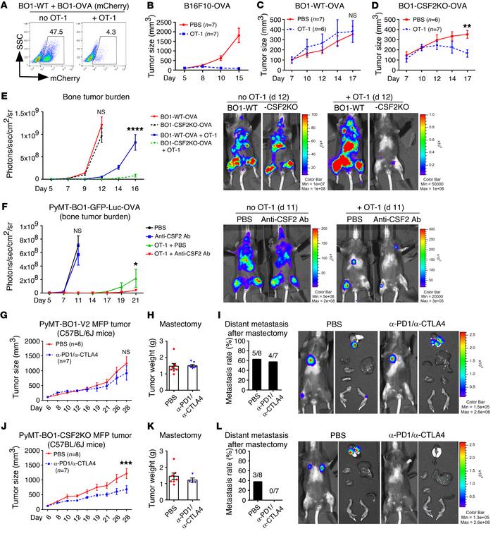Disruption of tumor cell–produced GM-CSF enhances breast cancer immune t...