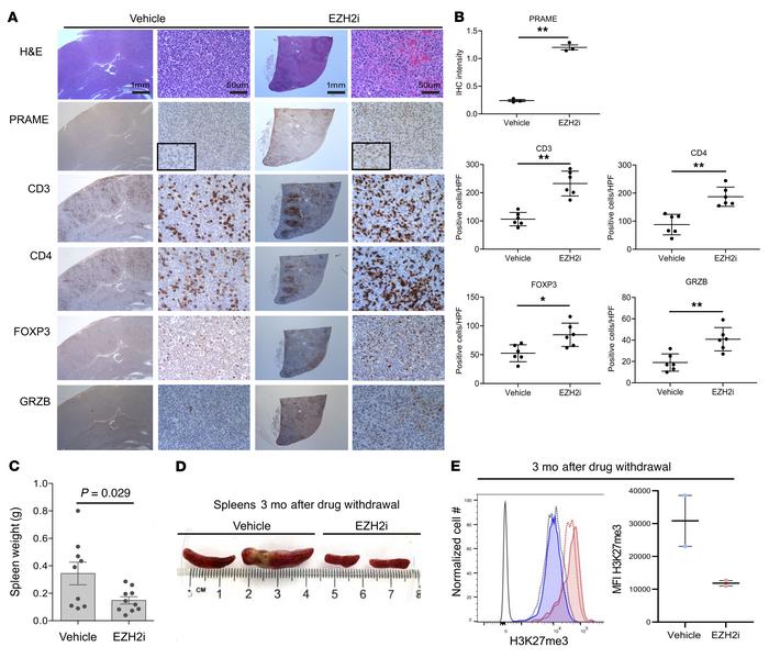 PRAME restoration and immune infiltrates change by EZH2 inhibitor in an ...