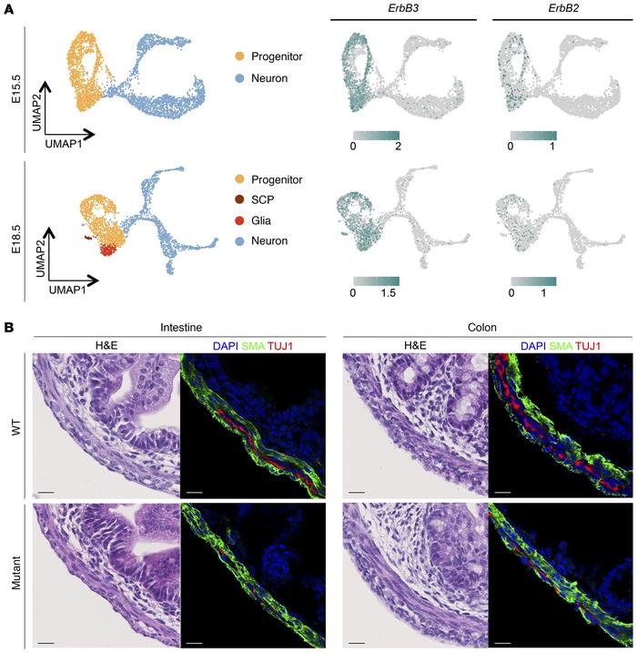 Investigation of the cell type specificity of ERBB3/ERBB2 in ENS and ISM...