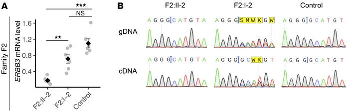 Decreased ERBB3 expression due to the c.3297delG variant.
(A) ERBB3 mRNA...