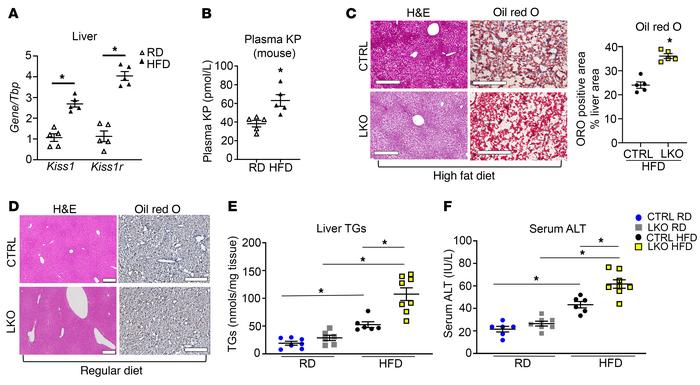 Hepatic Kiss1r-knockout mice exhibit increased hepatic steatosis in a di...