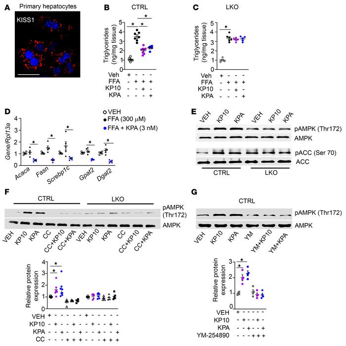 Kisspeptin inhibits triglyceride accumulation in isolated primary mouse ...